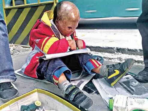 女儿被人贩子抱走，备受摧残5年后被寻回！ 